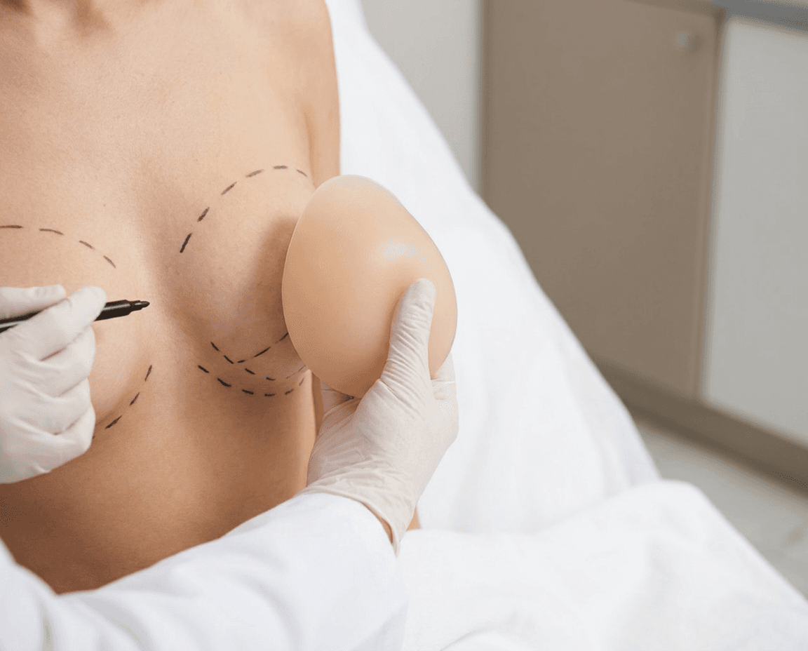 Stöd-bh och implantatprov inför val av implantat